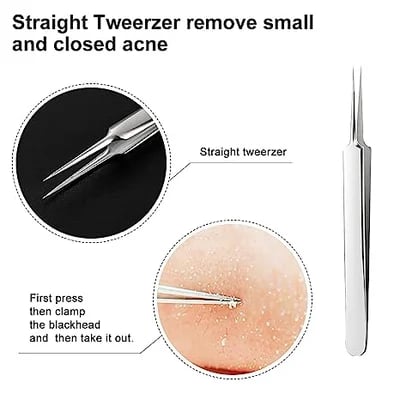 Professional Facial Blackhead Remover Tweezers