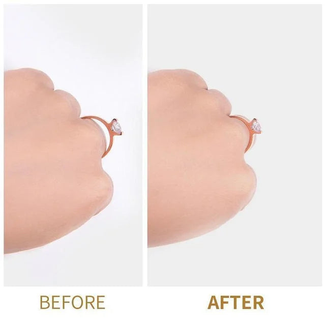 š„ Ring Re-sizer Set