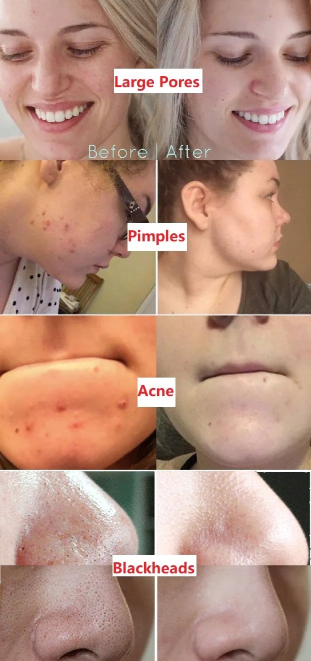 š2024 New Year Hot SalešDeep Cleanse Green Tea plant cleaning paste