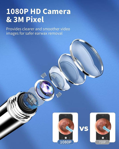 🔥Clean Earwax-Wi-Fi Visible Wax Removal Spoon, USB 1296P HD Load Otoscope