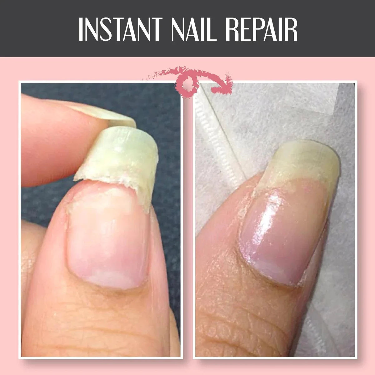 🔥48% OFF🔥Nail Repair Protection Gel