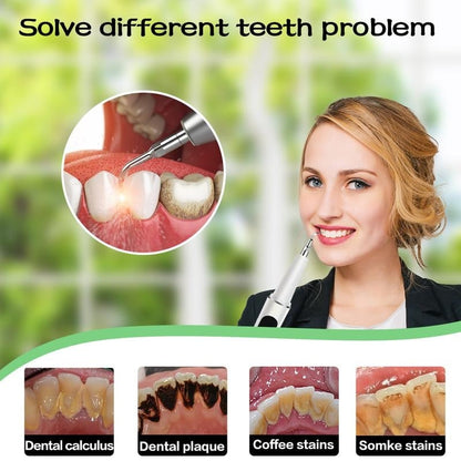 🔥LAST DAY 49% OFF🔥Plaque/Tartar Remover for Teeth, Dental Calculus Remover Teeth Cleaning Kit