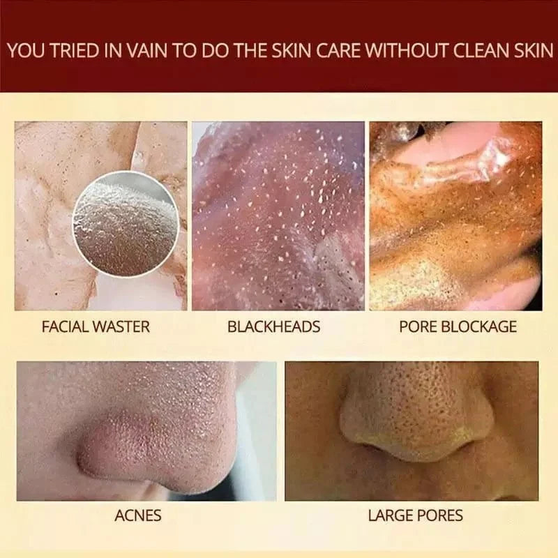 🔥 49% OFF🔥Pro-Herbal Refining Peel-Off Facial Mask