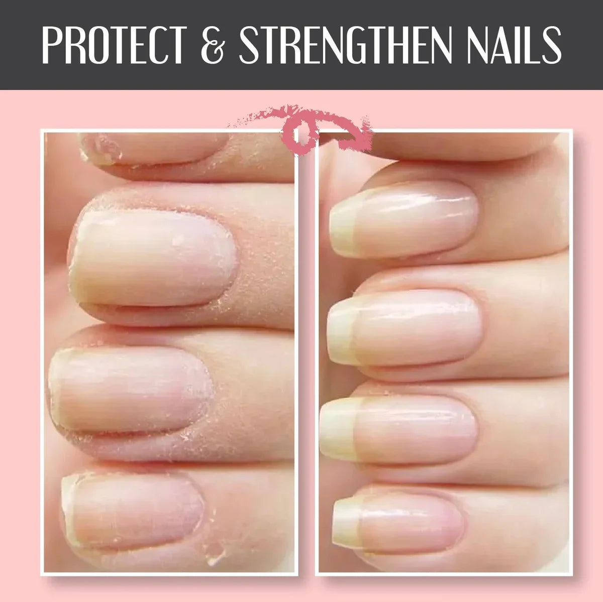 🔥48% OFF🔥Nail Repair Protection Gel