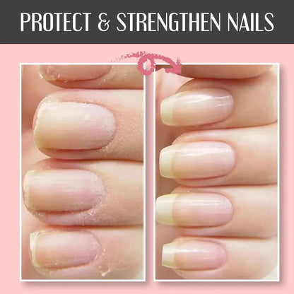🔥48% OFF🔥Nail Repair Protection Gel