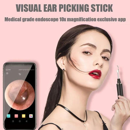 🔥Clean Earwax-Wi-Fi Visible Wax Removal Spoon, USB 1296P HD Load Otoscope