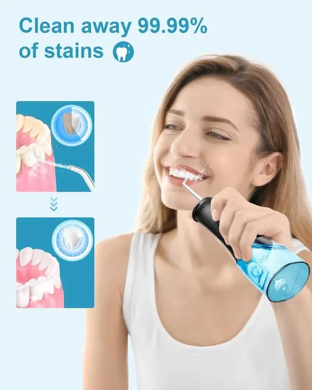 Teeth Cleaning with 3 Modes 4 Jet Tips IPX6 Waterproof Teethfloss for Home Travel，300ML Water Tank Water Flosser